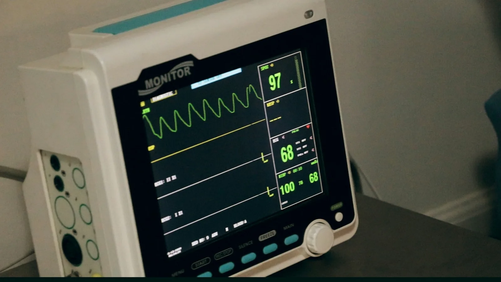 A bedside medical monitor showing vital signs